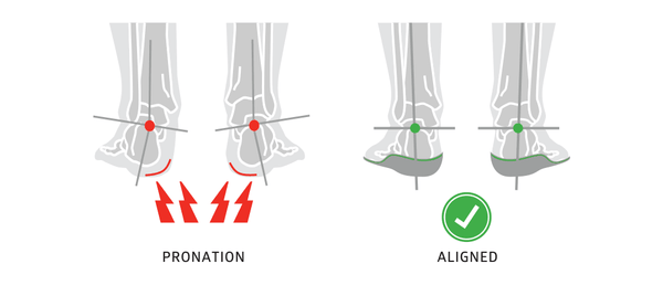 How Pronation, Overpronation and Supination Affect You?